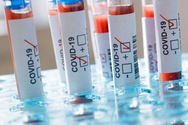 Przychodnia na Hallera prowadzi badania na przeciwciała anty SARS-Cov-2